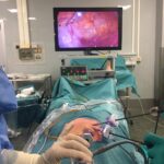 intervento ernia laparoscopia Dr Rovagnati