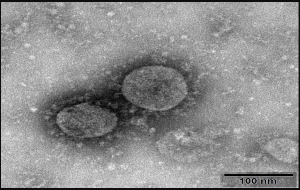 covid-19 fotografato dal microscopio elettronico